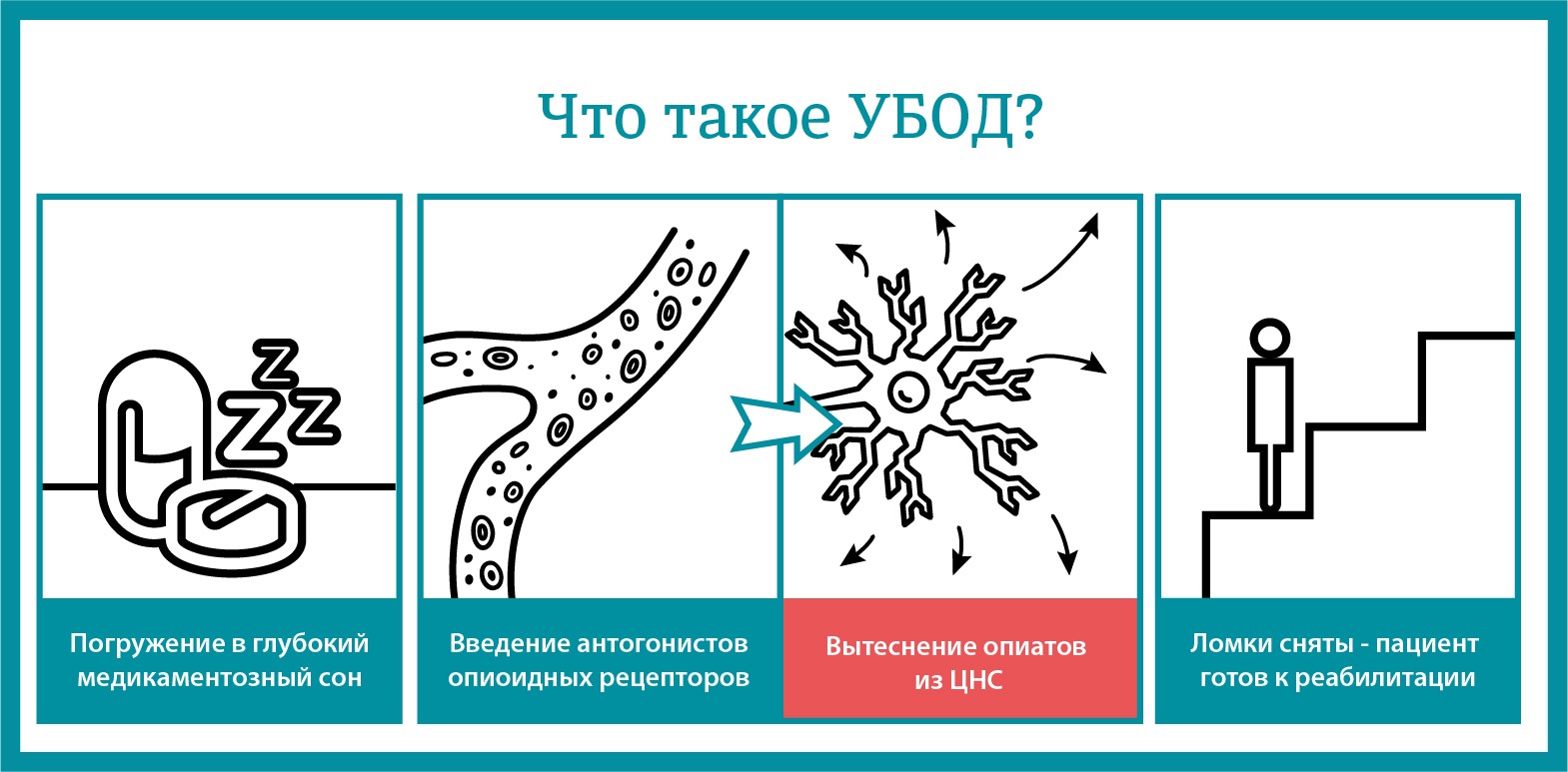 Детоксикация убод. Ультрабыстрая опиоидная детоксикация. УБОД. УБОД ультрабыстрая опиоидная.